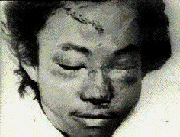Trajano-dead